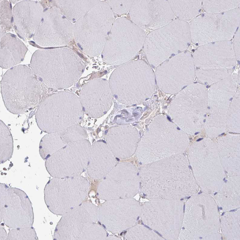 Immunohistochemistry (Formalin/PFA-fixed paraffin-embedded sections) - Anti-ELOVL1/SSC1 antibody - C-terminal (AB204489)
