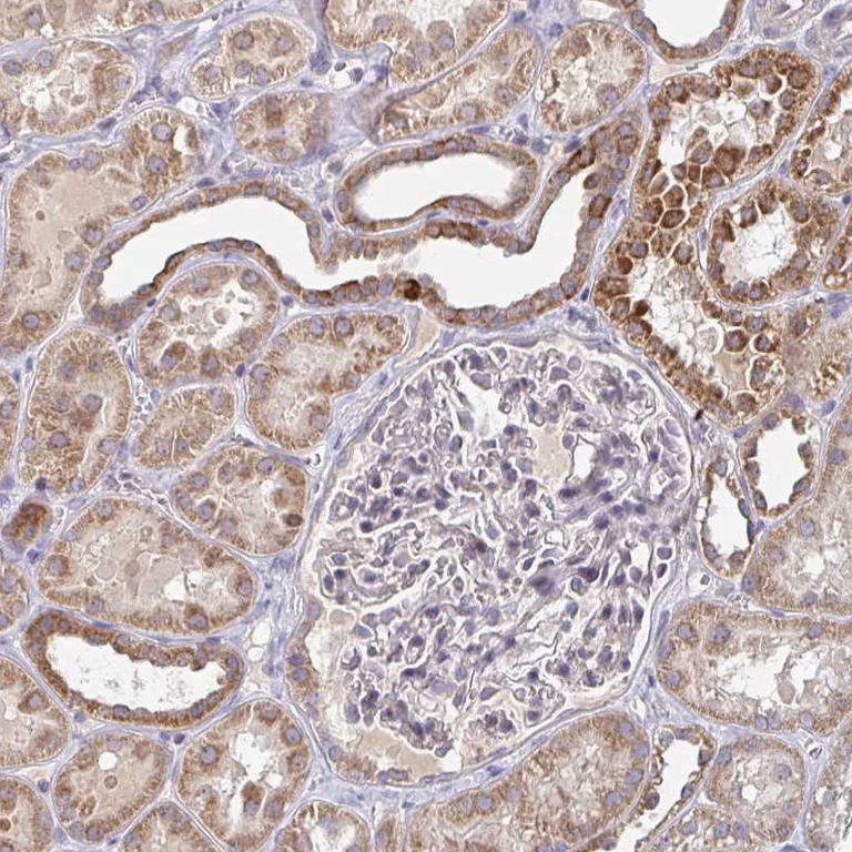 Immunohistochemistry (Formalin/PFA-fixed paraffin-embedded sections) - Anti-ELOVL1/SSC1 antibody - C-terminal (AB204489)