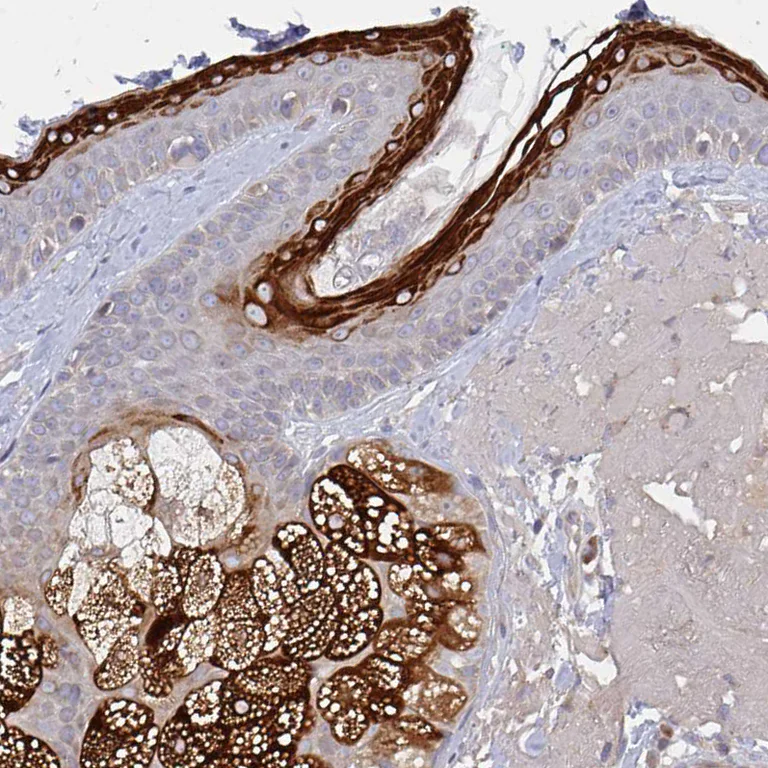 Immunohistochemistry (Formalin/PFA-fixed paraffin-embedded sections) - Anti-ELOVL1/SSC1 antibody - C-terminal (AB204489)