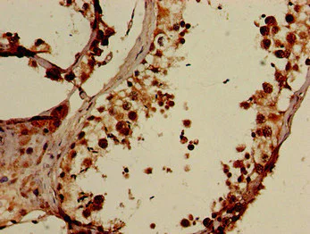 Immunohistochemistry (Formalin/PFA-fixed paraffin-embedded sections) - Anti-ELOVL4 antibody (AB224608)
