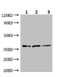 Western blot - Anti-ELOVL4 antibody (AB224608)