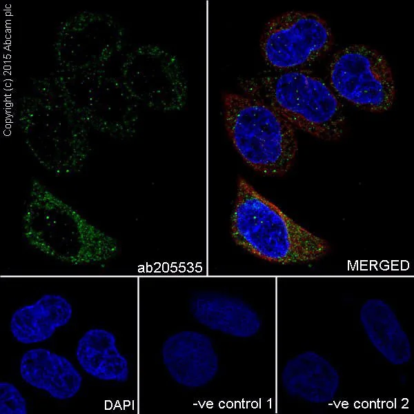 Immunocytochemistry/ Immunofluorescence - Anti-ELOVL5 antibody [EPR17151] (AB205535)
