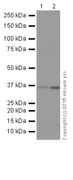 Western blot - Anti-ELOVL5 antibody [EPR17151] (AB205535)