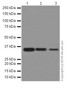 Western blot - Anti-ELOVL5 antibody [EPR17151] (AB205535), expandable thumbnail