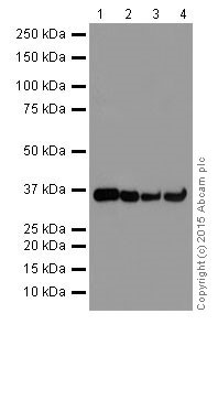 Western blot - Anti-ELOVL5 antibody [EPR17151] (AB205535), expandable thumbnail