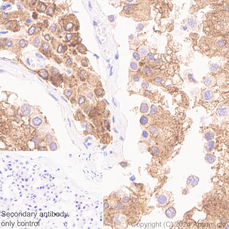 Immunohistochemistry (Formalin/PFA-fixed paraffin-embedded sections) - Anti-ELOVL5 antibody [EPR28824-94] - BSA and Azide free (AB318277)