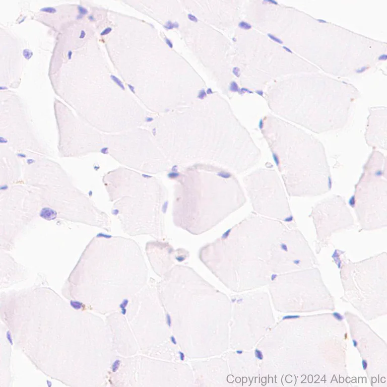 Immunohistochemistry (Formalin/PFA-fixed paraffin-embedded sections) - Anti-ELOVL5 antibody [EPR28824-94] - BSA and Azide free (AB318277)
