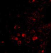 Immunocytochemistry/ Immunofluorescence - Anti-ELOVL6/LCE antibody (AB69857)