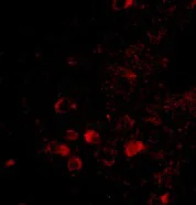 Immunocytochemistry/ Immunofluorescence - Anti-ELOVL6/LCE antibody (AB69857)