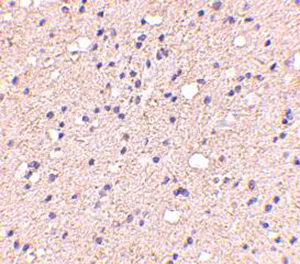 Immunohistochemistry (Formalin/PFA-fixed paraffin-embedded sections) - Anti-ELOVL6/LCE antibody (AB69857)