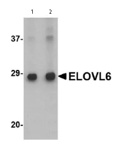Western blot - Anti-ELOVL6/LCE antibody (AB69857)