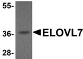 Western blot - Anti-ELOVL7 antibody (AB106633)