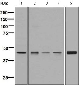Western blot - Anti-Elp4 antibody [EPR4200(2)] - BSA and Azide free (AB248617), expandable thumbnail