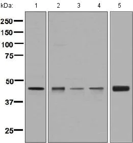 Western blot - Anti-Elp4 antibody [EPR4200(2)] - BSA and Azide free (AB248617)