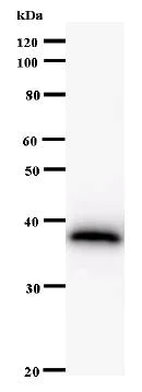 Western blot - Anti-ELYS antibody [2318C1a] (AB53540)