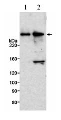 Western blot - Anti-ELYS antibody (AB14431)