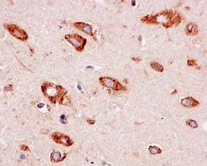 Immunohistochemistry (Formalin/PFA-fixed paraffin-embedded sections) - Anti-EMC4 antibody [EPR15080] (AB184544)