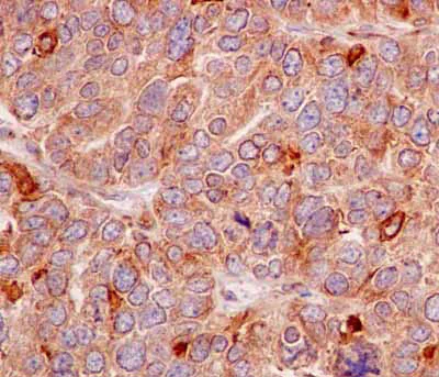 Immunohistochemistry (Formalin/PFA-fixed paraffin-embedded sections) - Anti-EMC4 antibody [EPR15080] (AB184544)