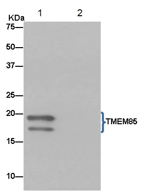 Immunoprecipitation - Anti-EMC4 antibody [EPR15080] (AB184544)