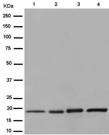 Western blot - Anti-EMC4 antibody [EPR15080] (AB184544)