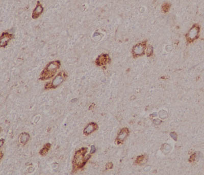 Immunohistochemistry (Formalin/PFA-fixed paraffin-embedded sections) - Anti-EMC4 antibody [EPR15081] - BSA and Azide free (AB250721), expandable thumbnail
