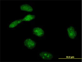 Immunocytochemistry/ Immunofluorescence - Anti-EME1 antibody (AB88878)