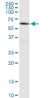 Western blot - Anti-EME1 antibody (AB88878)