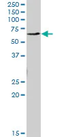 Western blot - Anti-EME1 antibody (AB88878)