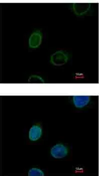 Immunocytochemistry/ Immunofluorescence - Anti-Emerin antibody (AB153718)