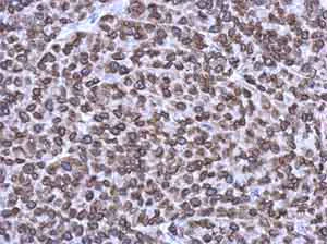 Immunohistochemistry (Formalin/PFA-fixed paraffin-embedded sections) - Anti-Emerin antibody (AB153718)