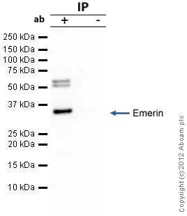Immunoprecipitation - Anti-Emerin antibody (AB40688)