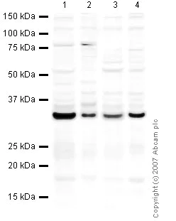 Western blot - Anti-Emerin antibody (AB40688)