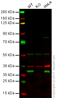 Western blot - Anti-Emerin antibody (AB40688)