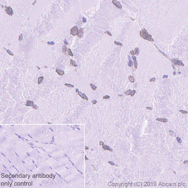 Immunohistochemistry (Formalin/PFA-fixed paraffin-embedded sections) - Anti-Emerin antibody [EPR11071] (AB156871)