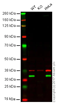 Western blot - Anti-Emerin antibody [EPR11071] (AB156871)