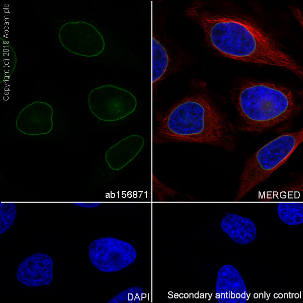 Immunocytochemistry/ Immunofluorescence - Anti-Emerin antibody [EPR11071] - BSA and Azide free (AB240138), expandable thumbnail