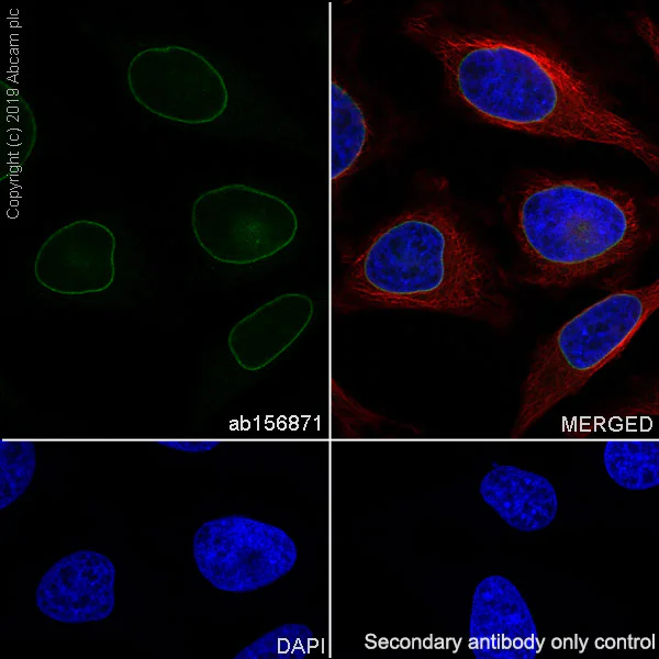 Immunocytochemistry/ Immunofluorescence - Anti-Emerin antibody [EPR11071] - BSA and Azide free (AB240138)
