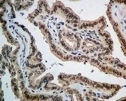 Immunohistochemistry (Formalin/PFA-fixed paraffin-embedded sections) - Anti-Emerin antibody [EPR11071] - BSA and Azide free (AB240138)