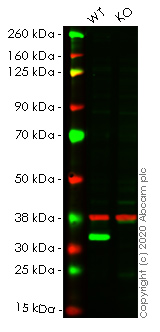 Western blot - Anti-Emerin antibody [EPR11071] - BSA and Azide free (AB240138), expandable thumbnail