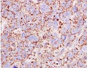Immunohistochemistry (Formalin/PFA-fixed paraffin-embedded sections) - Anti-Emi1 antibody [EPR15320] (AB184950)