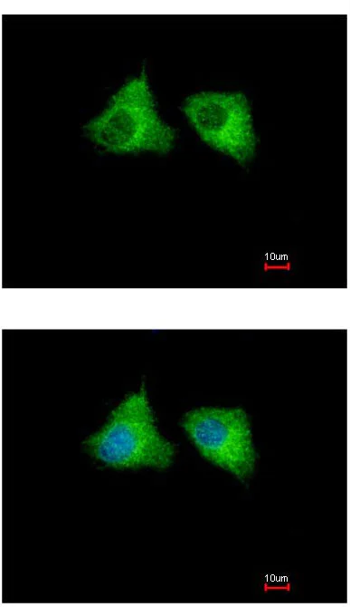 Immunocytochemistry/ Immunofluorescence - Anti-EML1 antibody - C-terminal (AB153703)