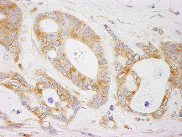 Immunohistochemistry (Formalin/PFA-fixed paraffin-embedded sections) - Anti-EML4 antibody (AB85834)