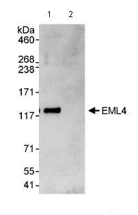 Immunoprecipitation - Anti-EML4 antibody (AB85834)