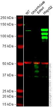 Western blot - Anti-EML4 antibody (AB85834)