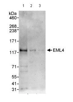Western blot - Anti-EML4 antibody (AB85834)
