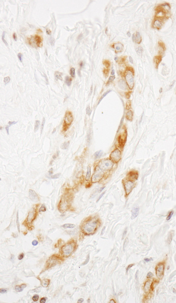 Immunohistochemistry (Formalin/PFA-fixed paraffin-embedded sections) - Anti-EML4 antibody (AB86062)