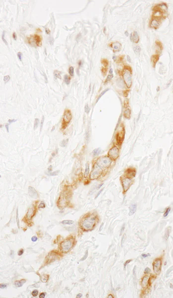 Immunohistochemistry (Formalin/PFA-fixed paraffin-embedded sections) - Anti-EML4 antibody (AB86062)