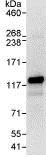 Immunoprecipitation - Anti-EML4 antibody (AB86062)