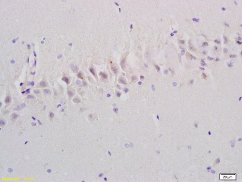 Immunohistochemistry (Formalin/PFA-fixed paraffin-embedded sections) - Anti-EMP-1 antibody (AB202975)