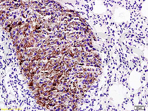 Immunohistochemistry (Formalin/PFA-fixed paraffin-embedded sections) - Anti-EMP-1 antibody (AB202975)